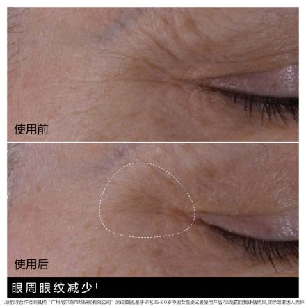 「双萃精华眼霜」娇韵诗双萃眼部焕亮精华